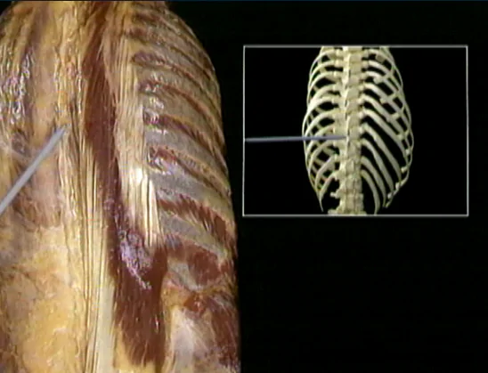 Źródło zdjęcia głównego: Acland’s Video Atlas of Human Anatomy / https://aclandanatomy.com