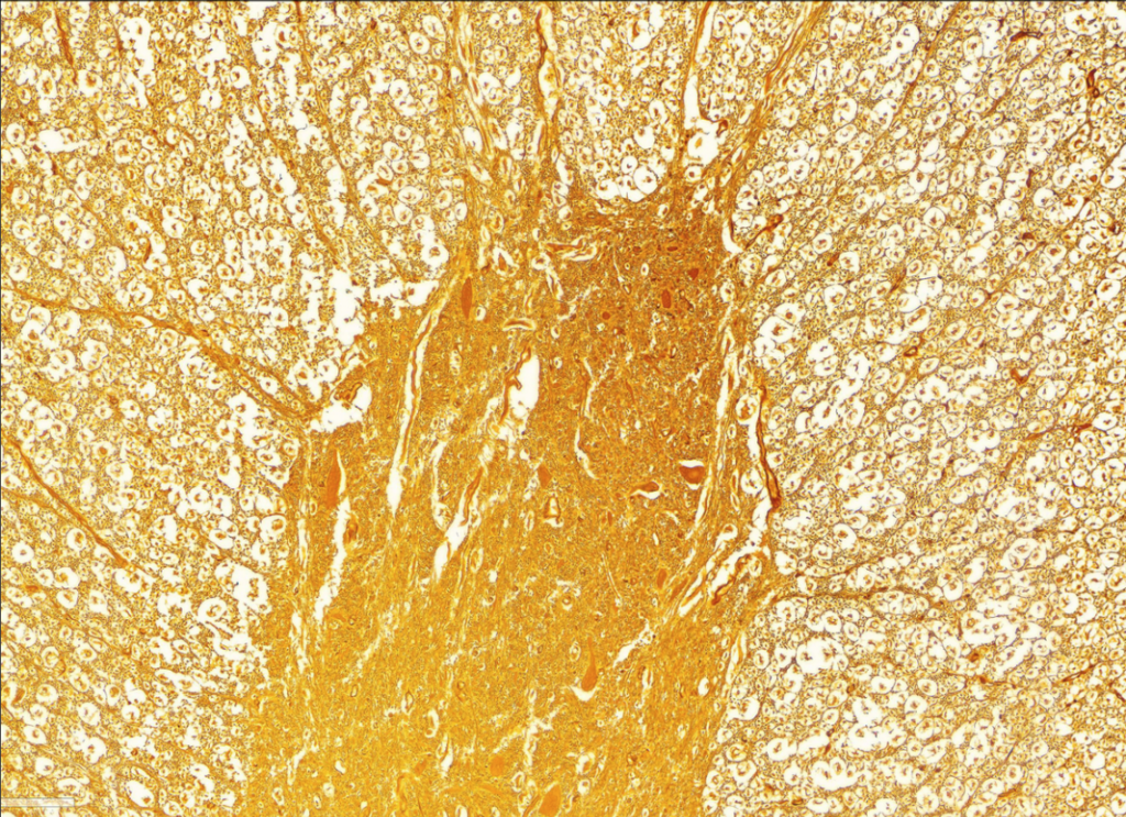 Istota biała i istota szara (rdzeń kręgowy). Źródło: Interaktywny Atlas Histologiczny
